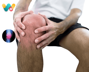 Osteoarthritis