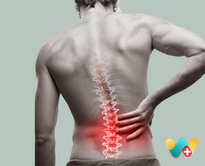 Ankylosing Spondylitis 