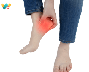 Calcaneal Spur