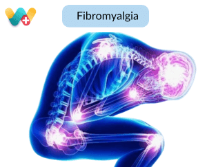 Fibromyalgia