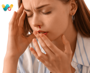 Nasal Bleeding