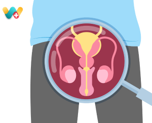 Prostate Enlargement